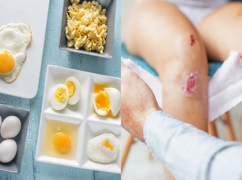 Không phải mọi thực phẩm truyền miệng đều cần kiêng khi có vết thương